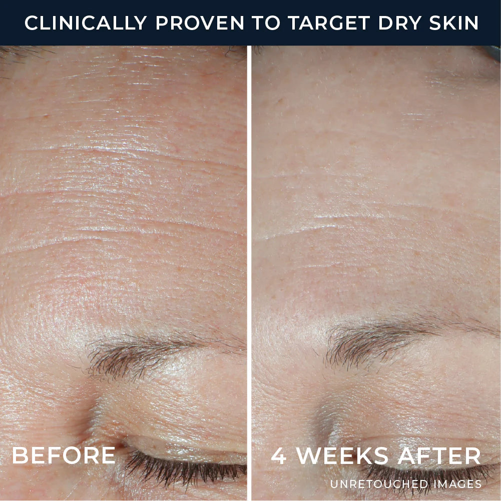 Hydration+ Moisturizer - Image 3