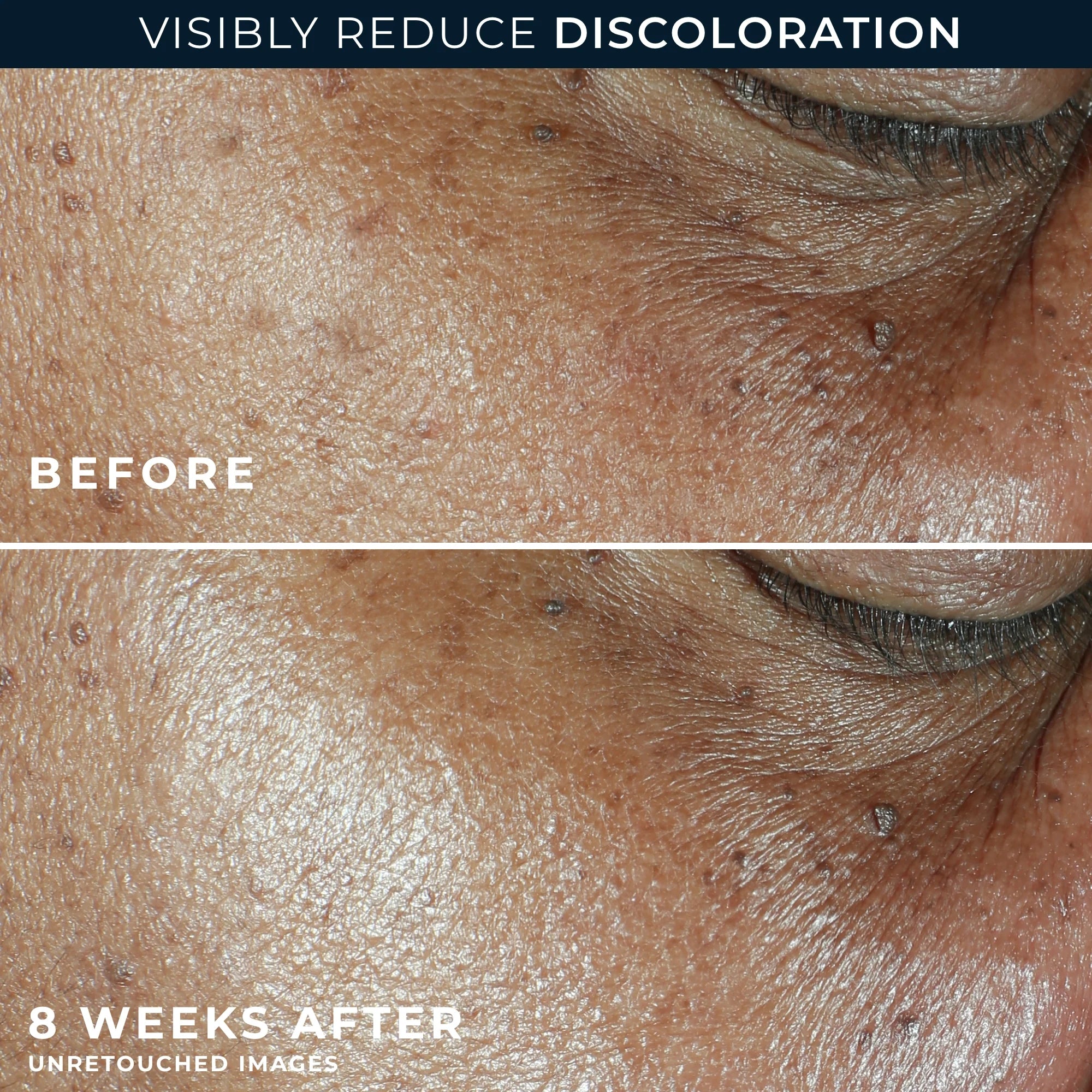 MULTI CORREXION® Even Tone + Lift Daily Moisturizer SPF 30 - Image 4