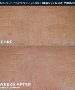 Alternative view of RETINOL CORREXION® Deep Wrinkle Rich Cream