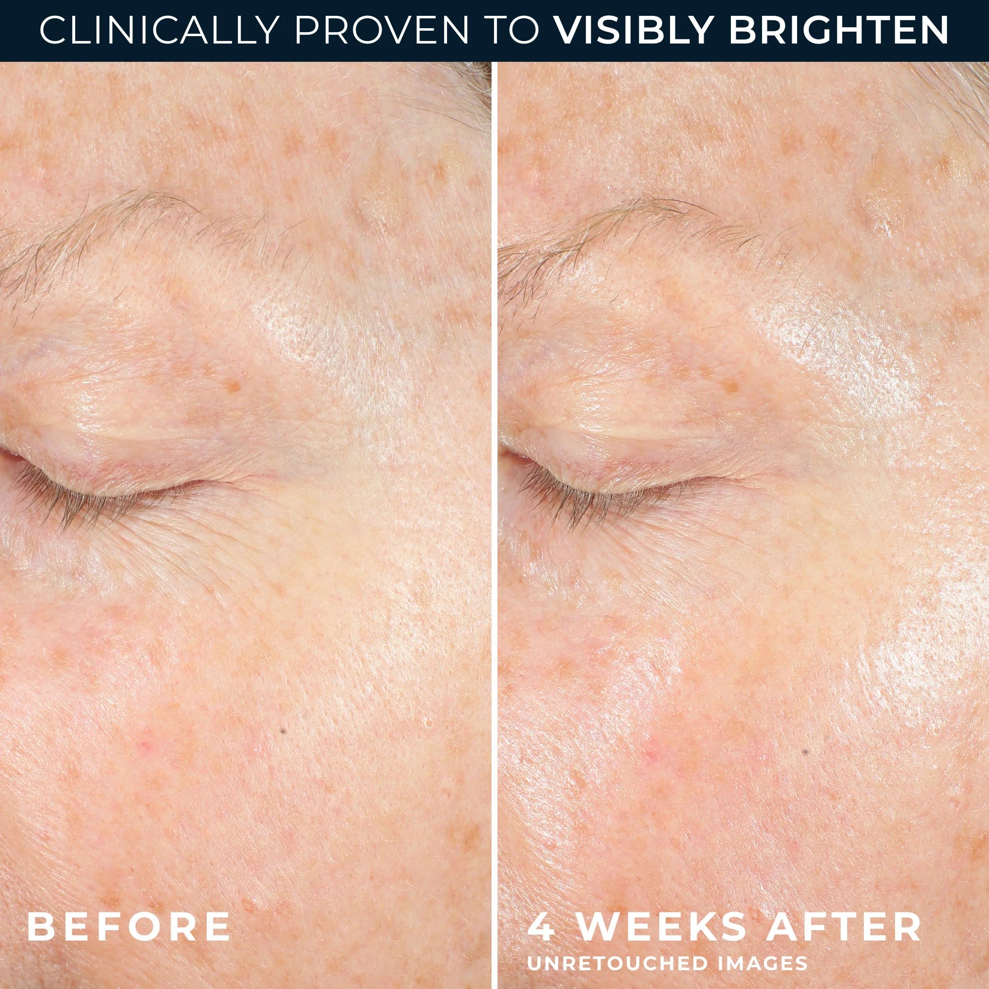 MULTI CORREXION® Revive + Glow Moisturizer - Image 4