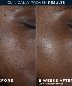 Alternative view of MULTI CORREXION® Even Tone + Lift Night Cream