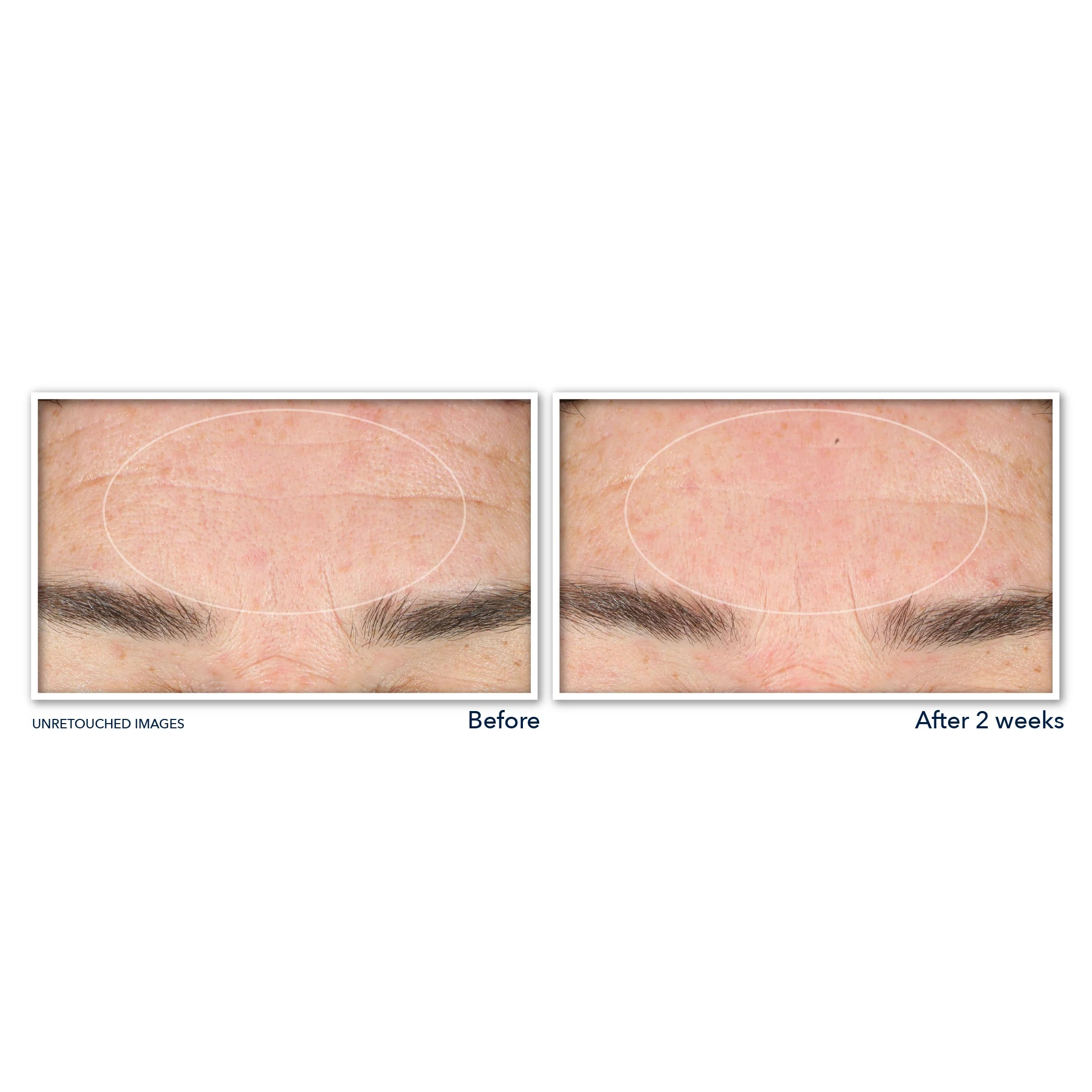 DERM CORREXION® Serum Cleanser - Image 6