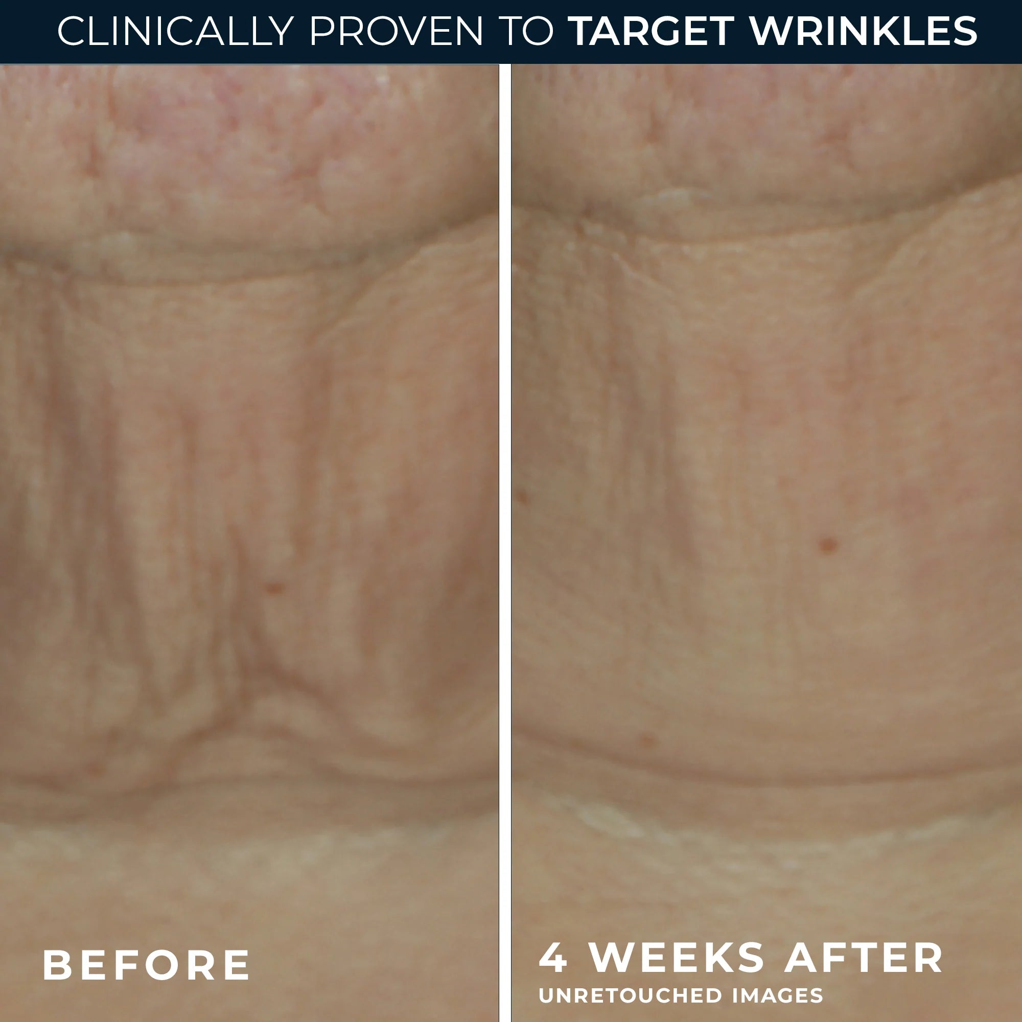 DERM CORREXION® Firming Serum Stick - Image 4