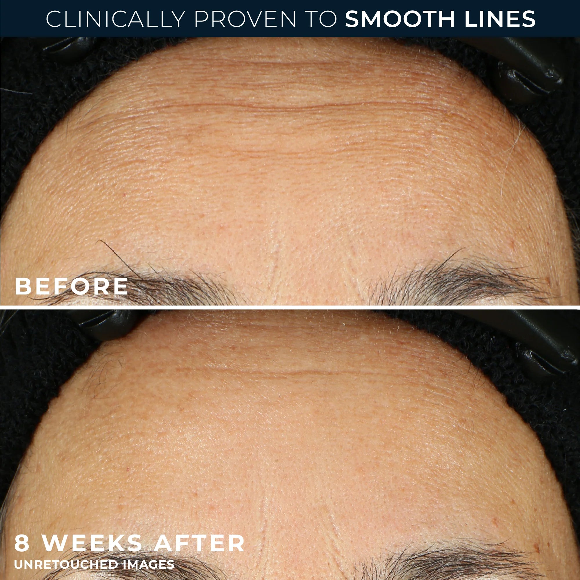 RETINOL CORREXION® Line Smoothing Night Serum Capsules - Image 4