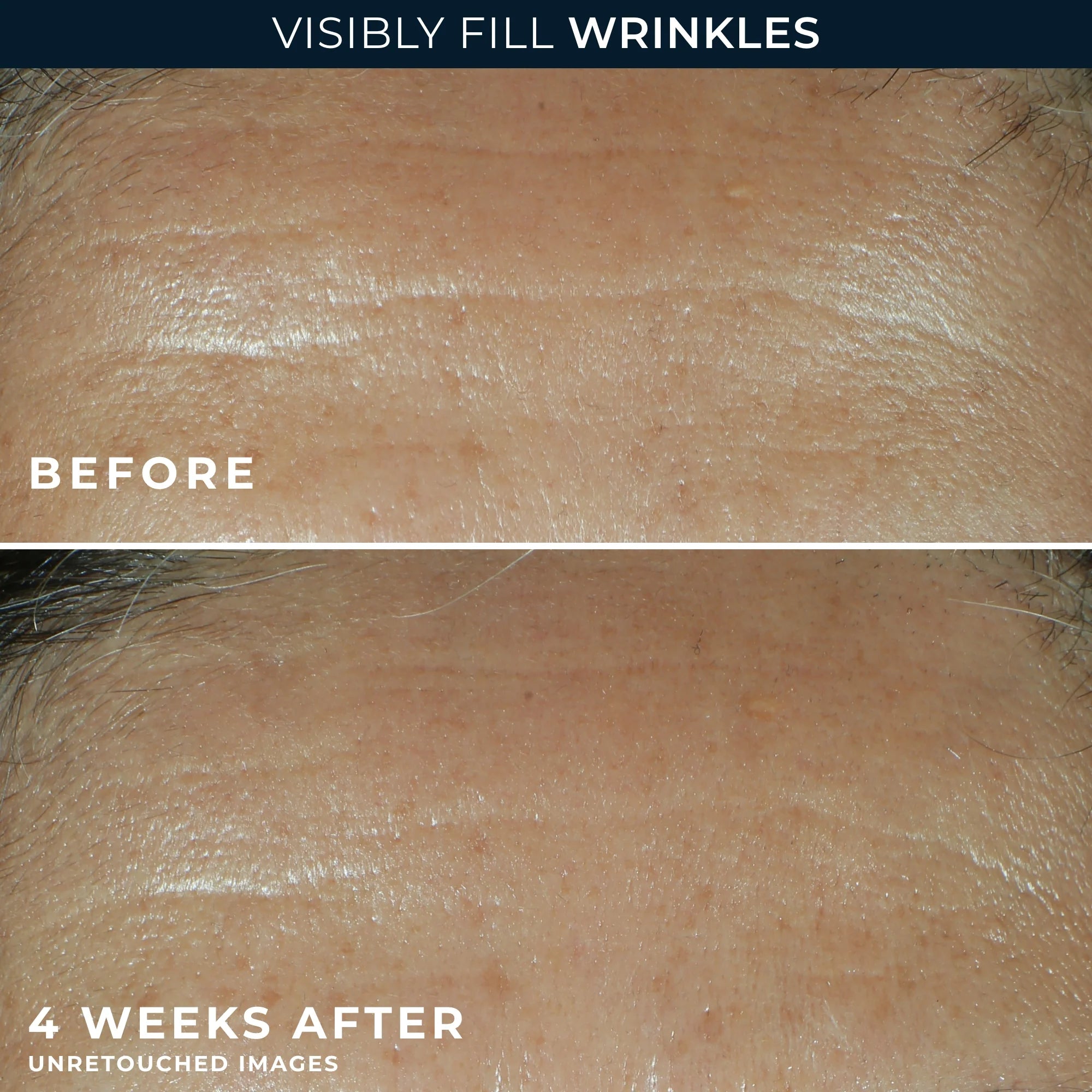 RETINOL CORREXION® Deep Wrinkle Filler - Image 2