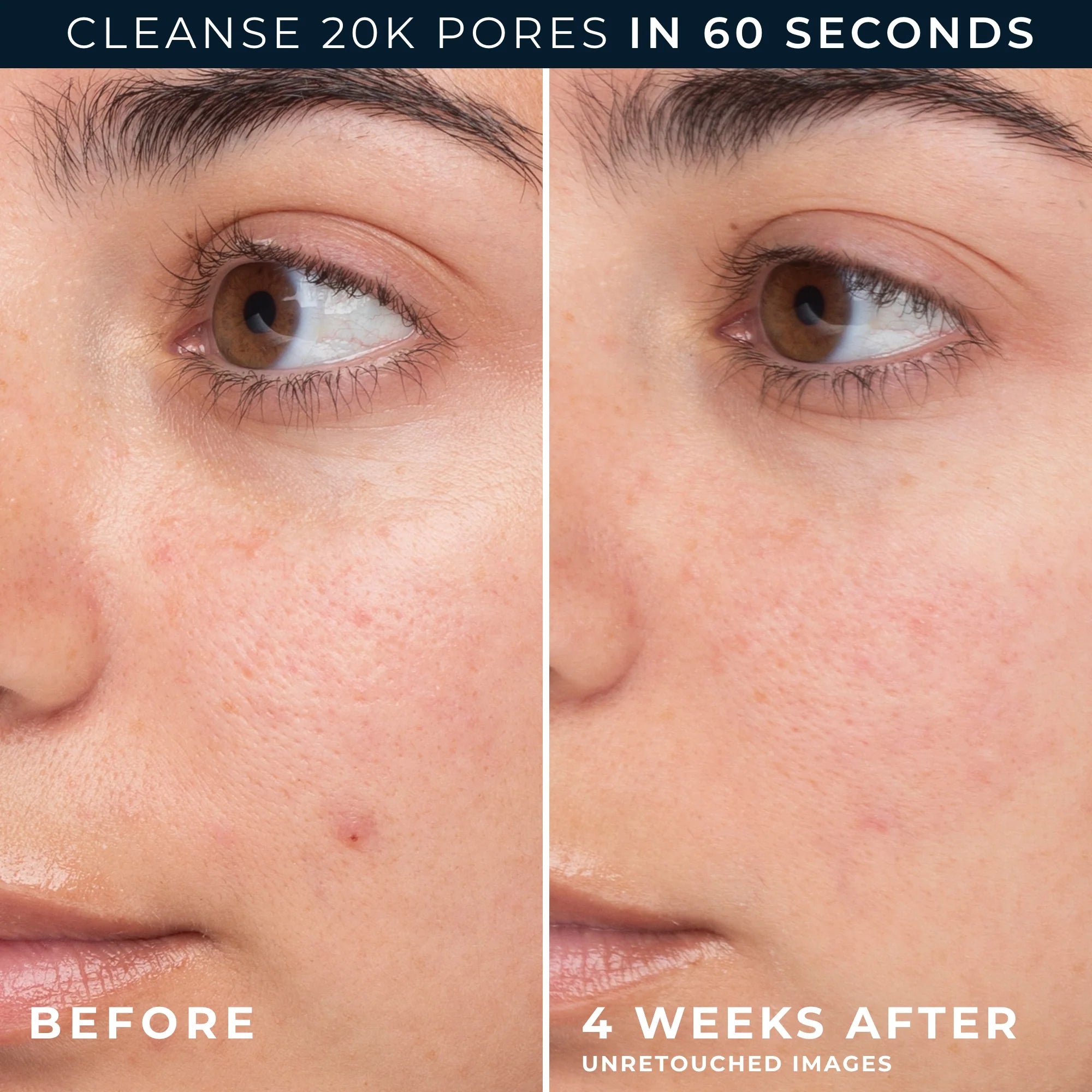 Barrier Renew® Gel-To-Foam Cleanser - Image 3