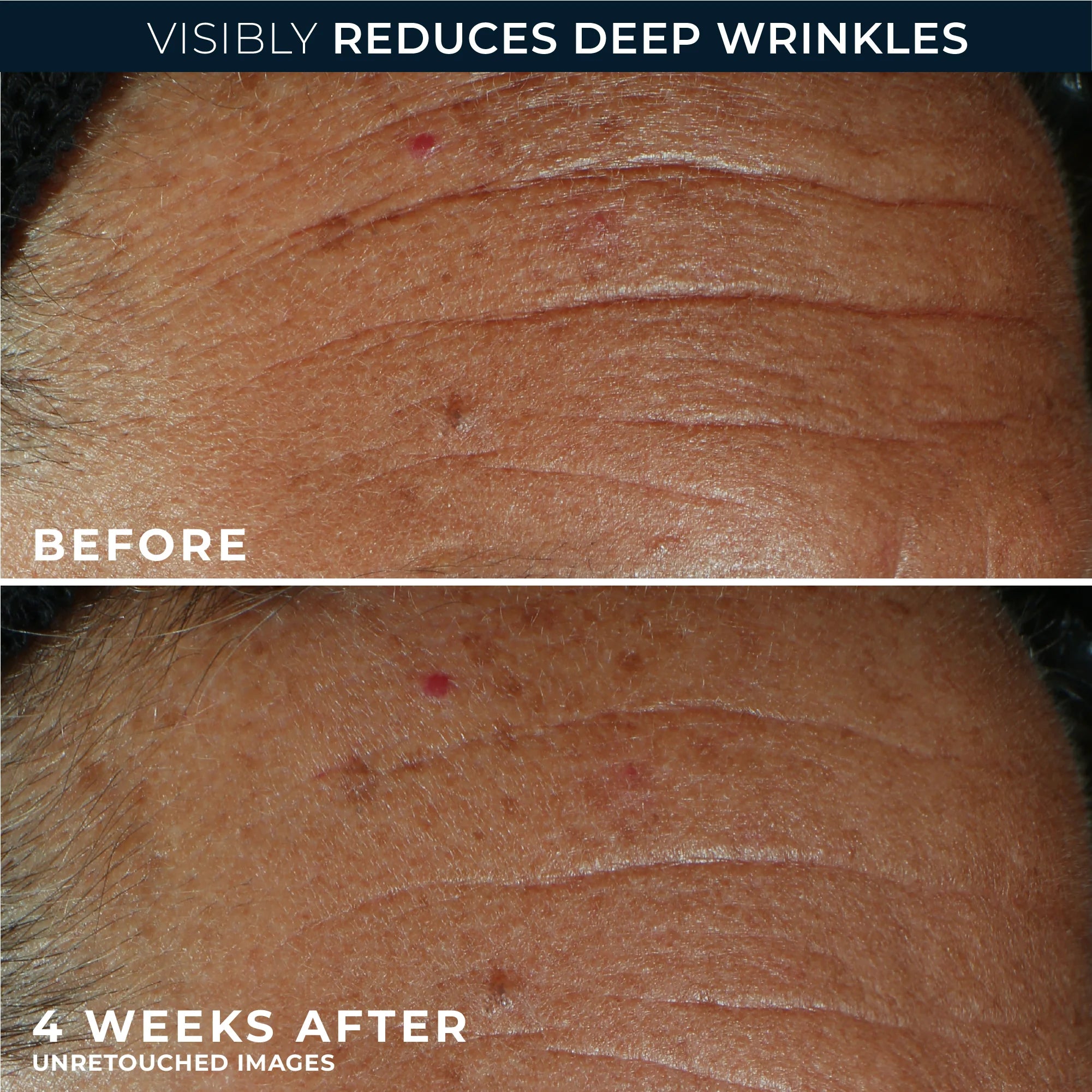 DERM CORREXION® Fill + Treat Serum - Image 4