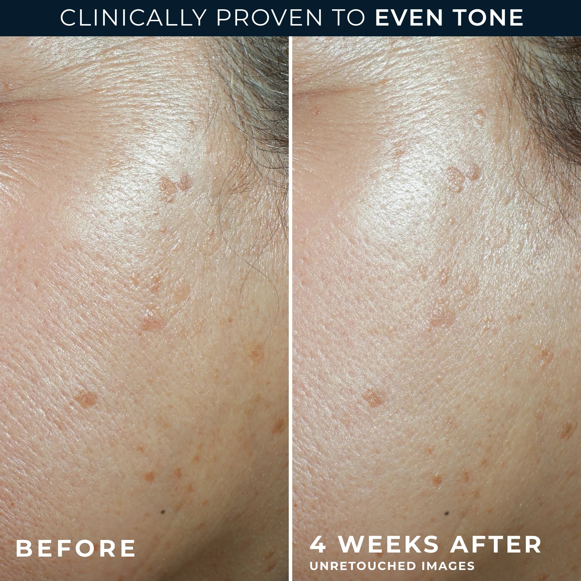 MULTI CORREXION® Even Tone + Lift Daily Moisturizer SPF 30 - Image 7