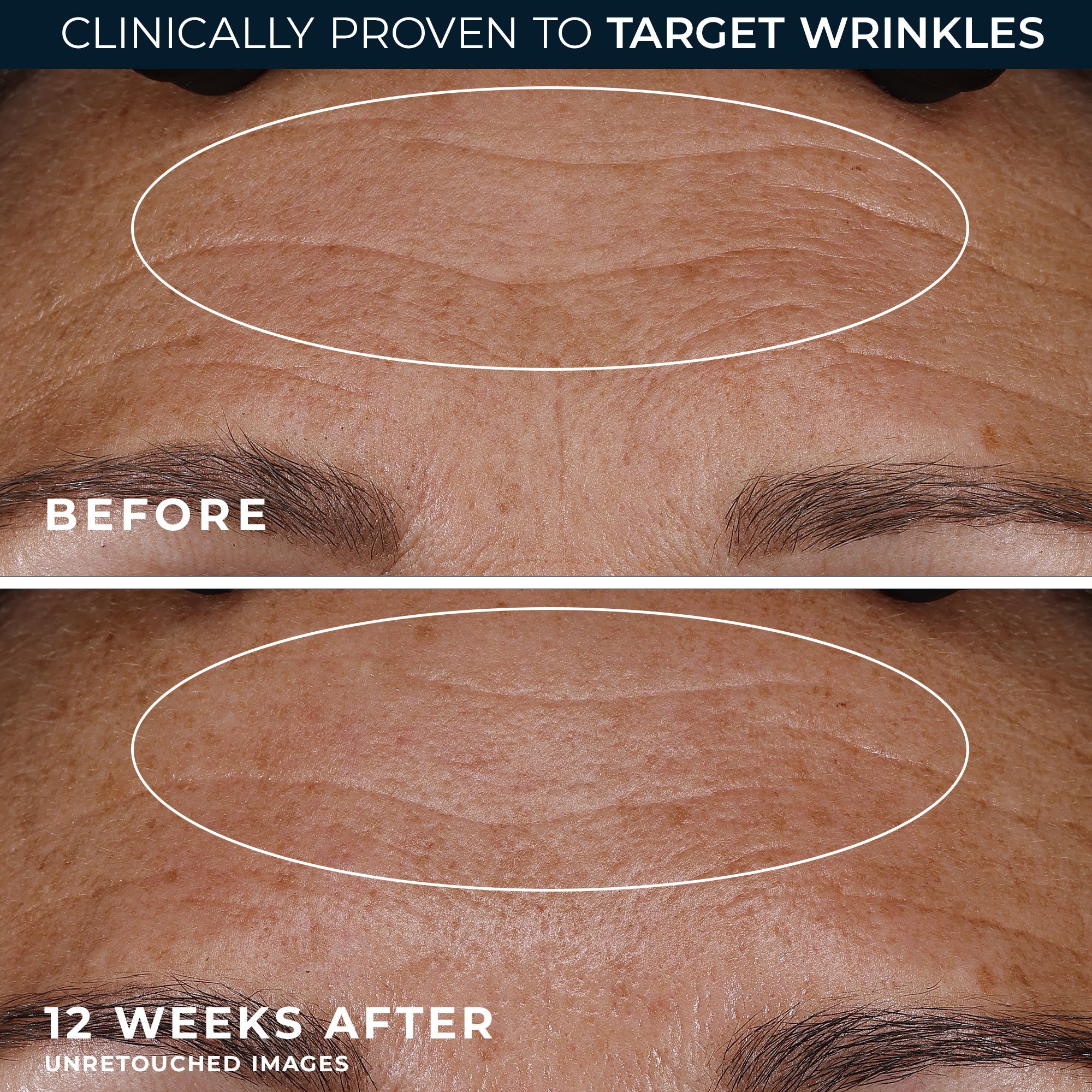 RETINOL CORREXION® Deep Wrinkle Night Cream - Image 7