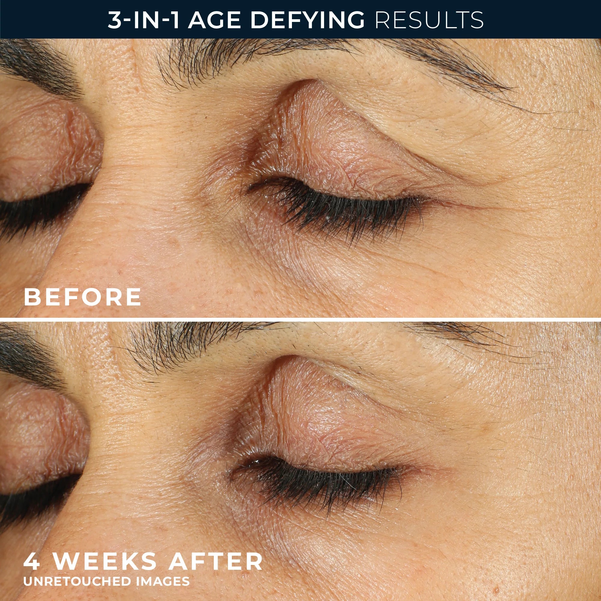 RETINOL CORREXION® Line Smoothing Eye Cream - Image 5