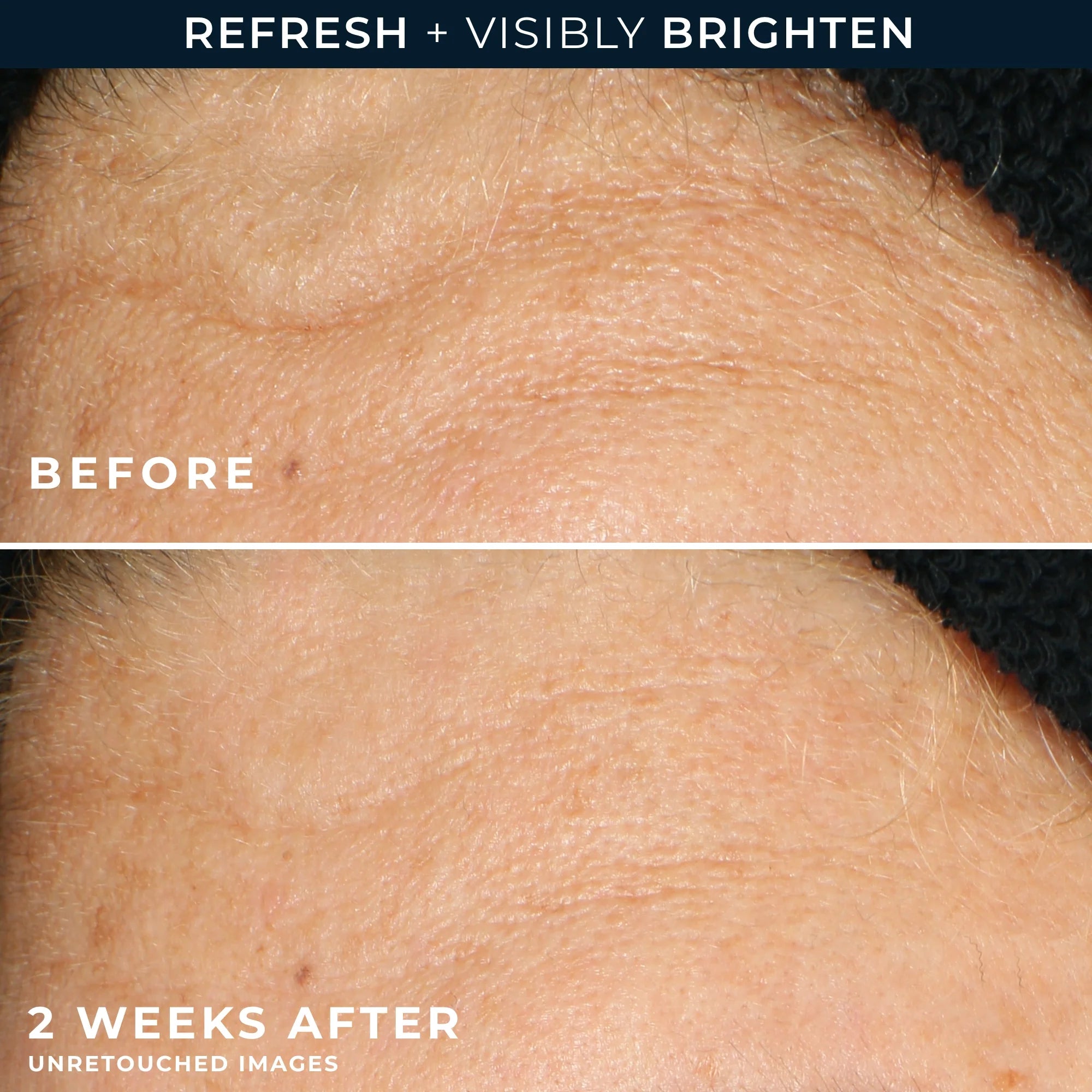 MULTI CORREXION® Revive + Glow Gel Cleanser - Image 4