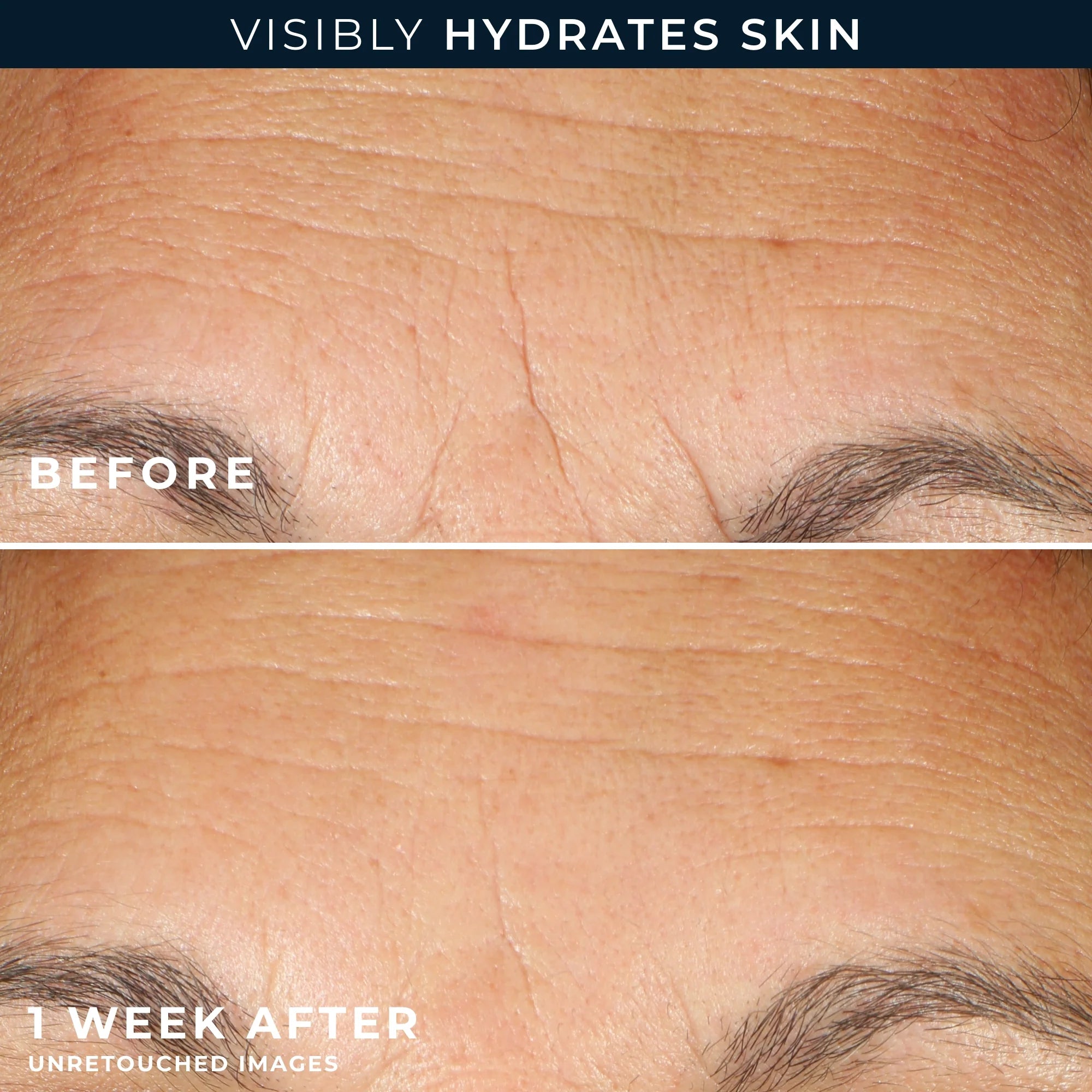 Hydration+ Serum Capsules - Image 5