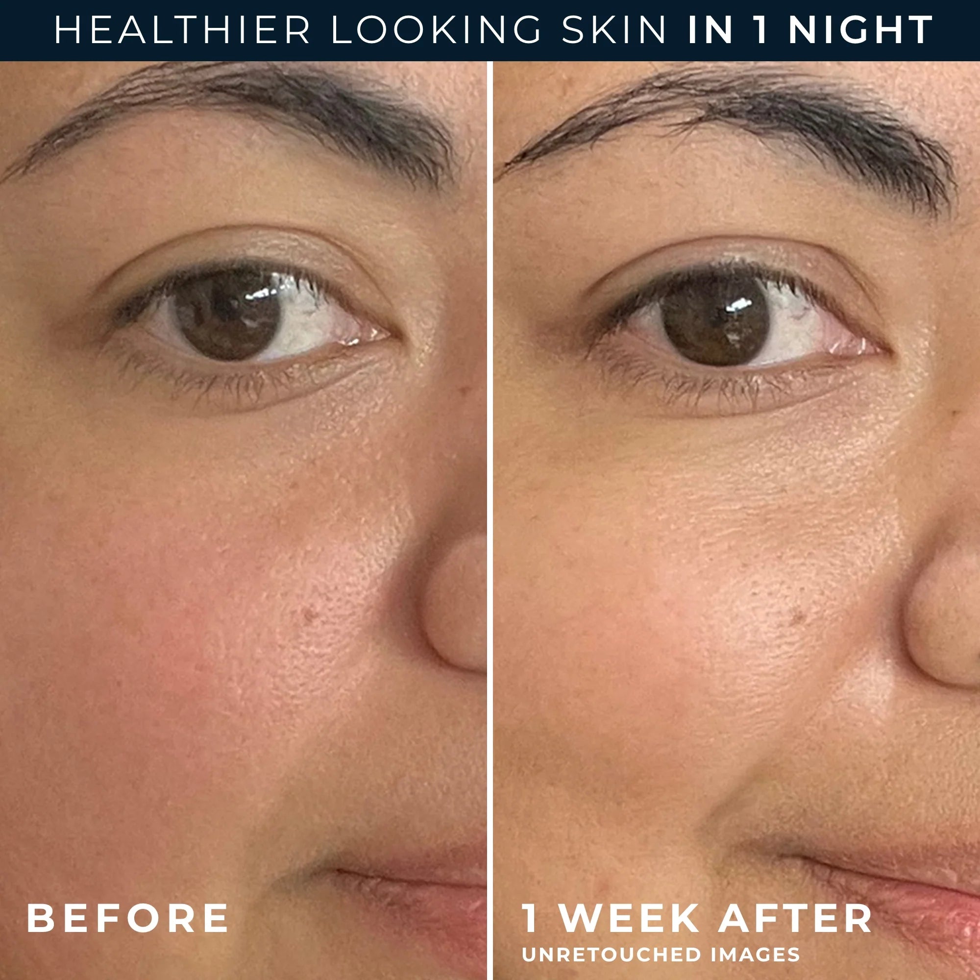 Barrier Renew® PM Moisturizer - Image 6