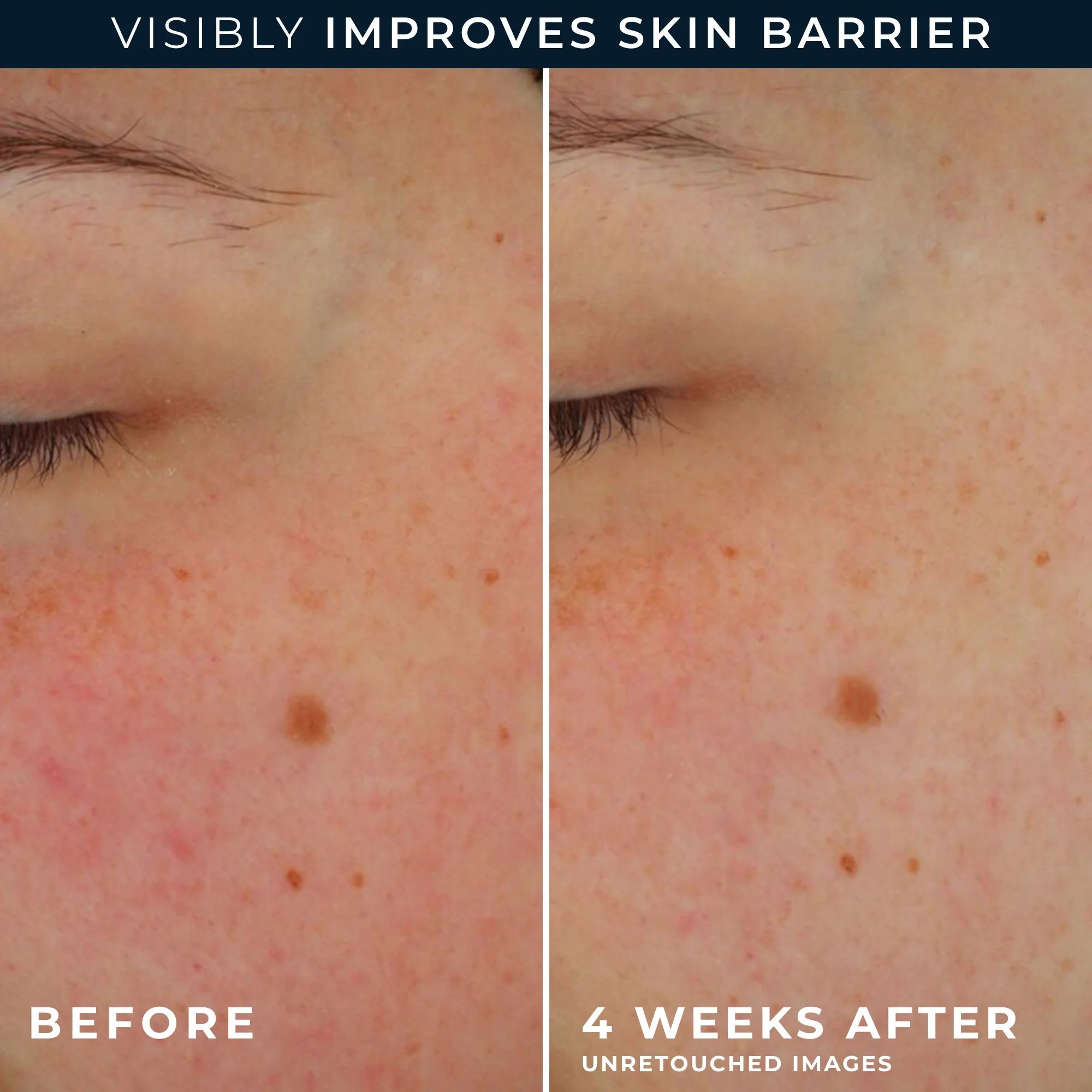 Barrier Renew® AM Moisturizer SPF 30 - Image 7